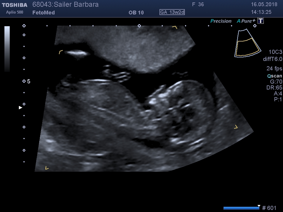 I201805161420331470002