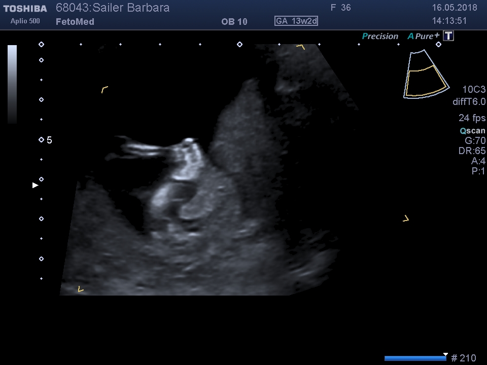 I201805161420385430004