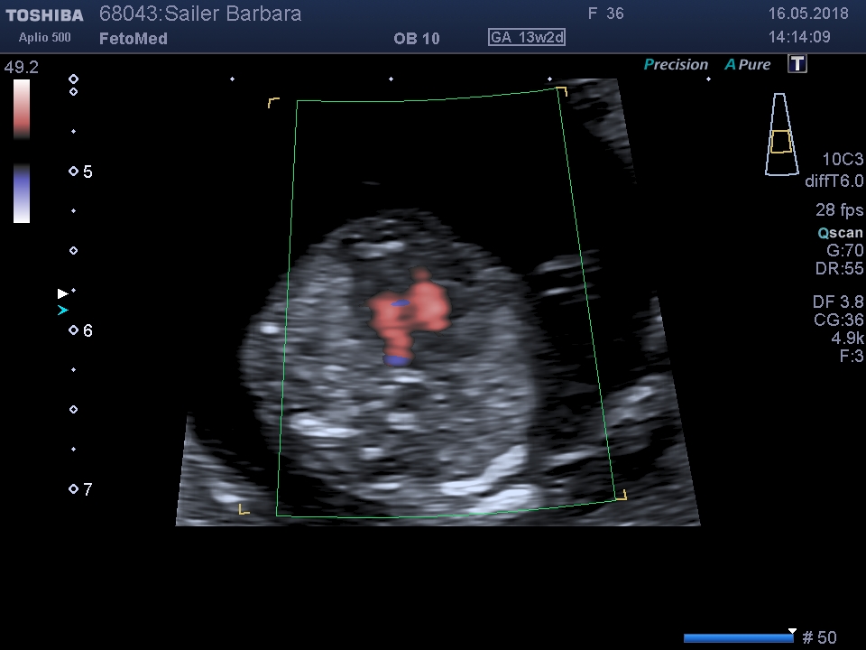 I201805161420401730006