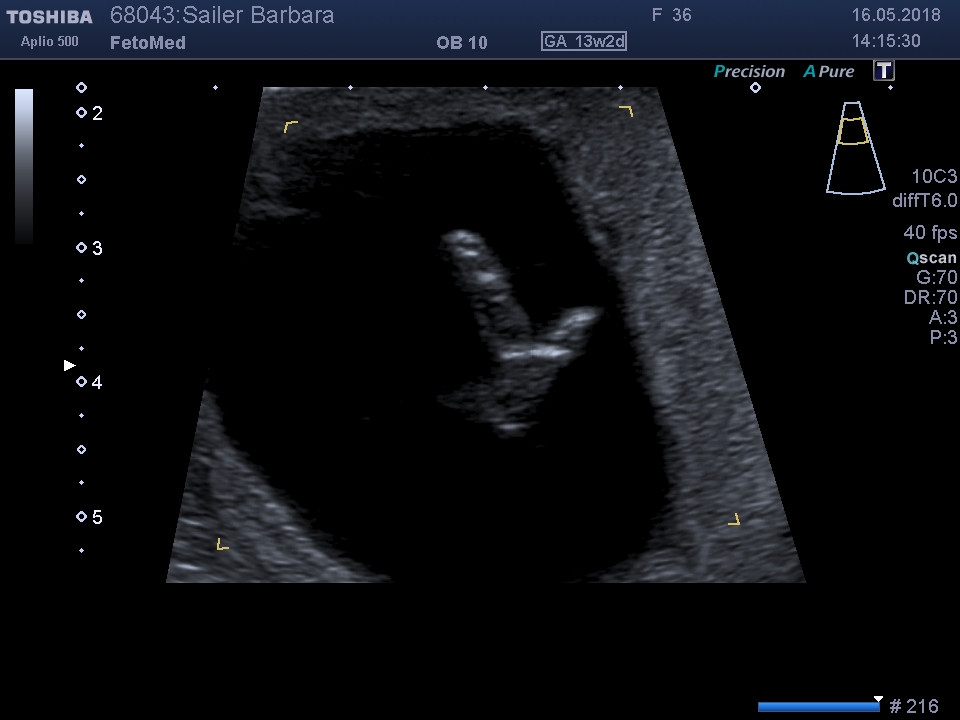 I201805161420401950007