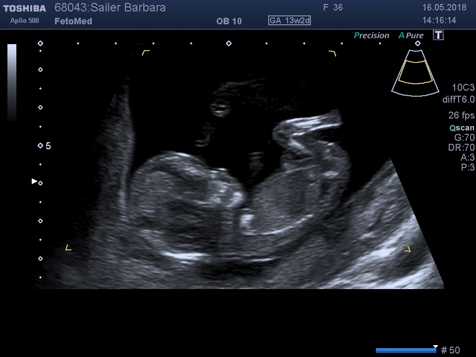 I201805161420427350009