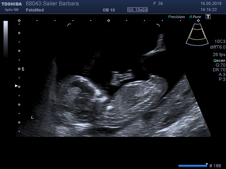 I201805161420479900011