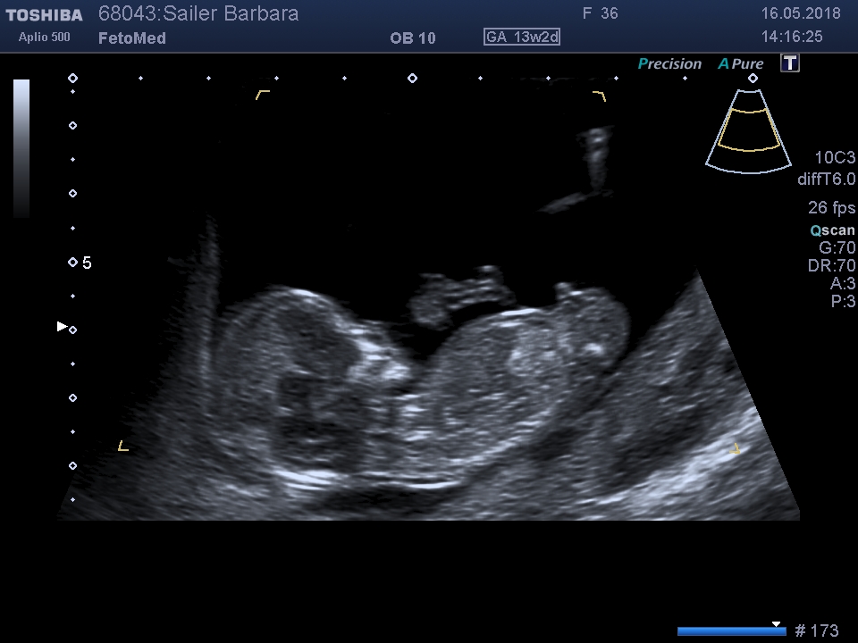 I201805161420480140012