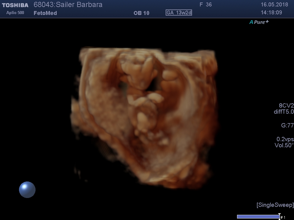 I201805161420520490014