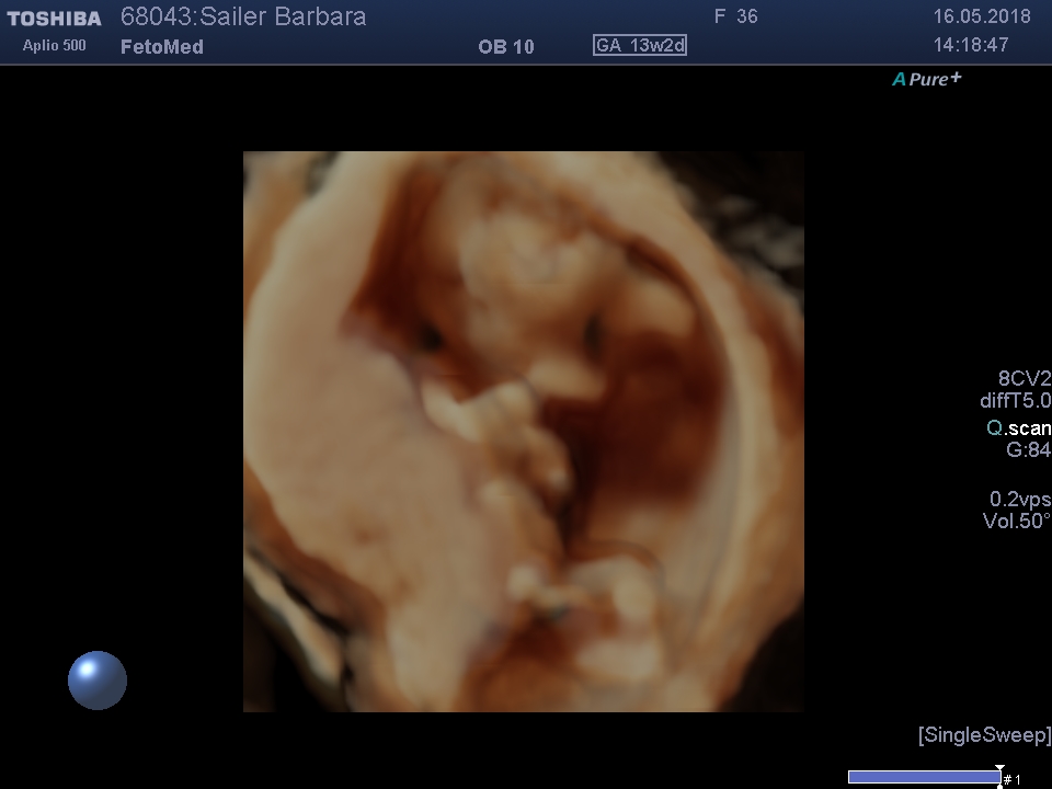 I201805161420520710015