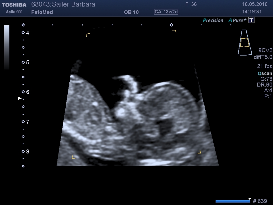 I201805161420520920016