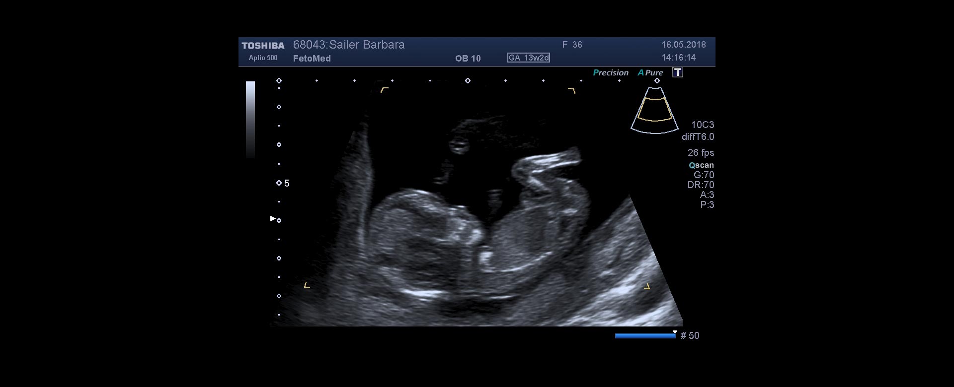 slide-nackenfaltenmessung